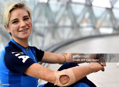 Fencing champion's Italian Beatrice Vio poses before the 